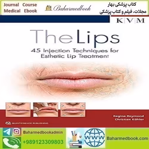 The Lips 45 Injection Techniques for Esthetic Lip Treatment دانلود
