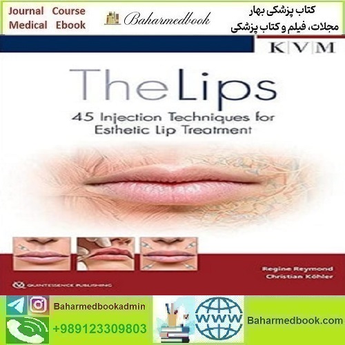 The Lips 45 Injection Techniques for Esthetic Lip Treatment دانلود