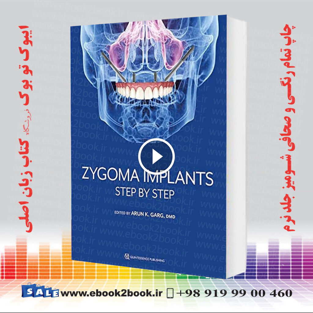 Zygoma Implants: Step by Step