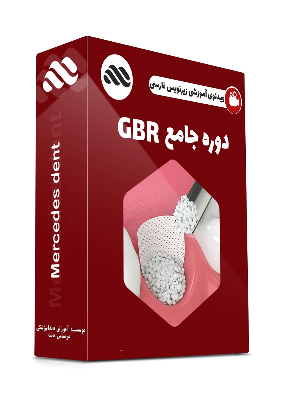 ویدئوی عملی بازسازی افقی و عمودی استخوان