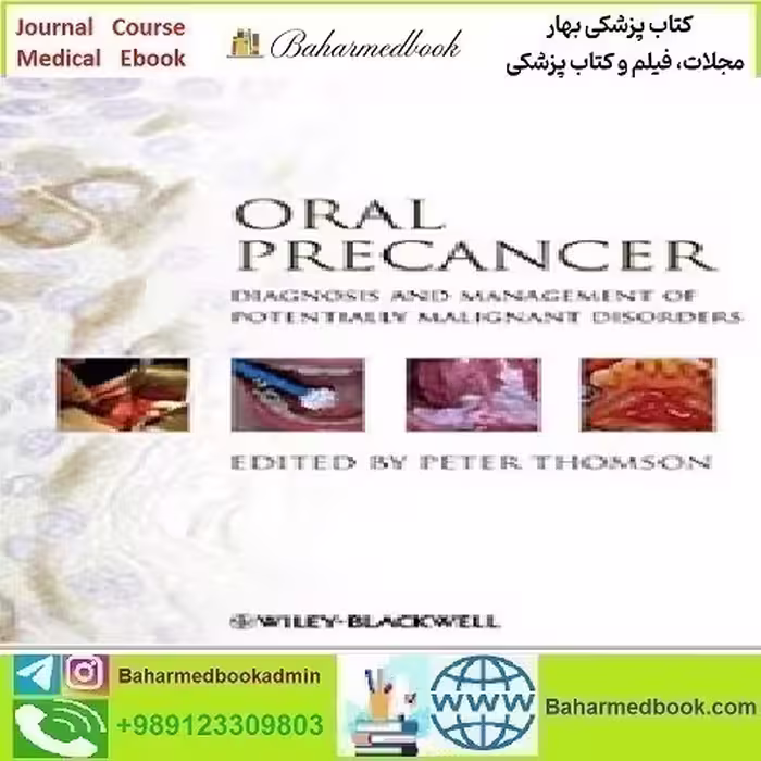 Oral Precancer Diagnosis and Management of Potentially Malig