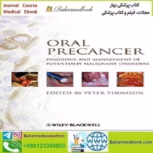 Oral Precancer Diagnosis and Management of Potentially Malig
