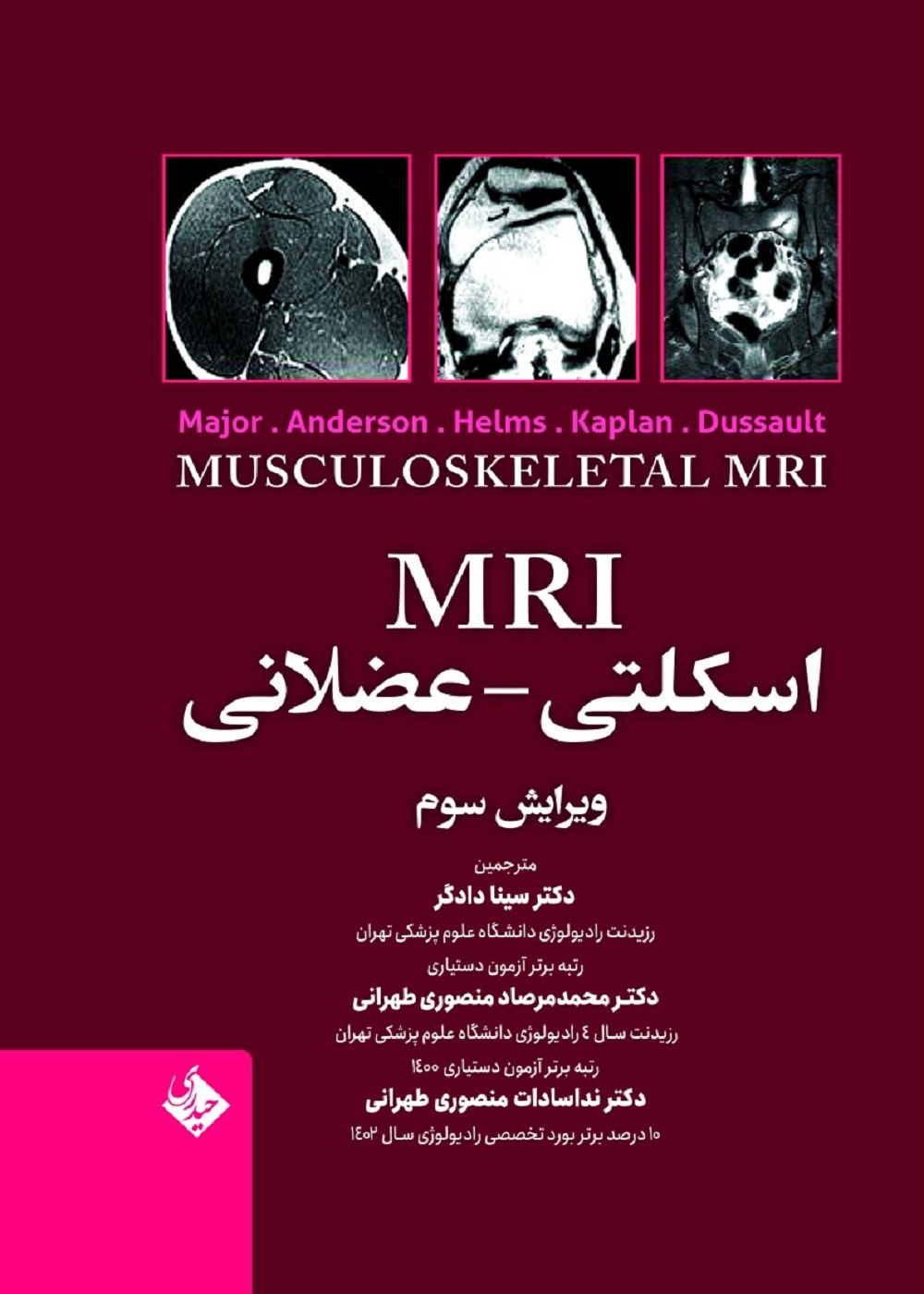 MRI اسکلتی - عضلانی