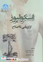 قیمت و خرید کتاب اسکولیوز از ارزیابی تا اصلاح | ایده بوک