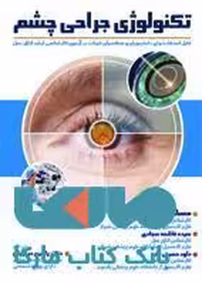 تکنولوژی جراحی چشم نشر حیدری