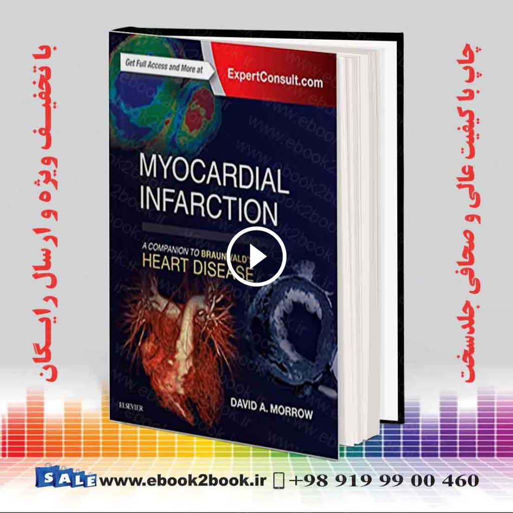 Myocardial Infarction: A Companion to Braunwald’s Heart Disease