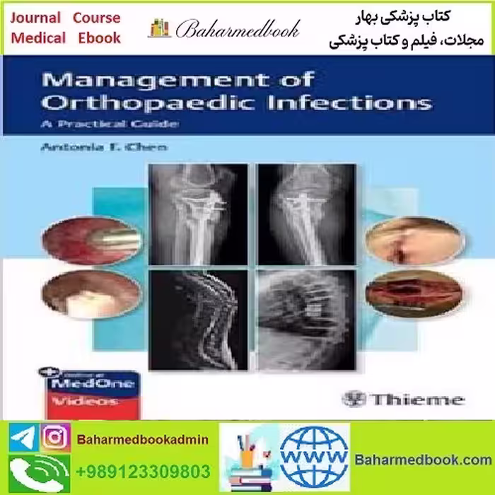 Management of Orthopaedic Infections A Practical Guide TRUE