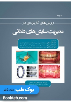 روش های کاربردی در مدیریت سایش های دندانی 2020