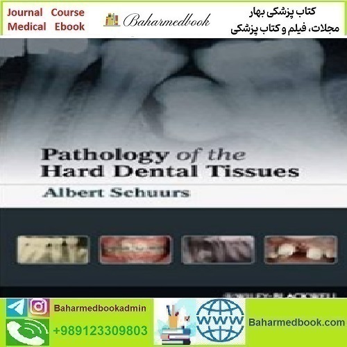 Pathology of the Hard Dental Tissues 2013 TRUE PDF price 1€ - کتاب پزشکی بهار