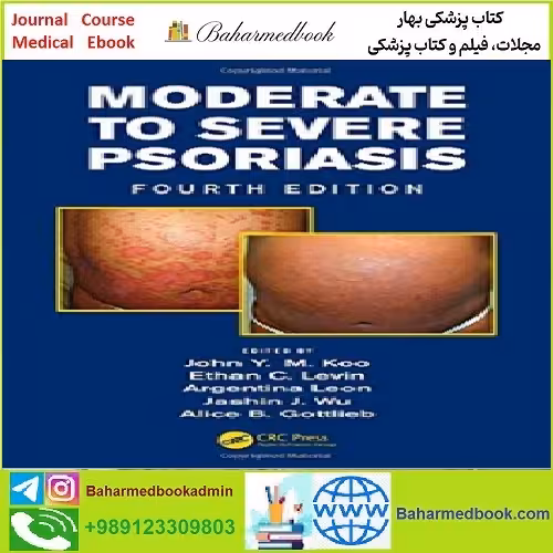 Moderate to Severe Psoriasis TRUE PDF price 1€ - کتاب پزشکی بهار