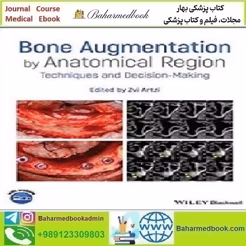 Bone Augmentation by Anatomical Region 2020 TRUE