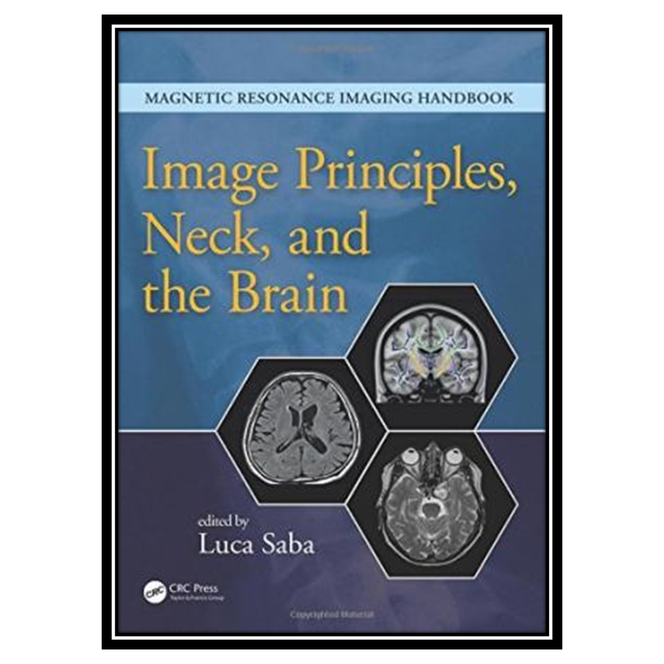 کتاب Image Principles Neck and the Brain اثر Luca Saba انتشارات مؤلفین طلایی