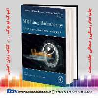 MR Linac Radiotherapy: A New Personalized Treatment Approach (Volume 8)