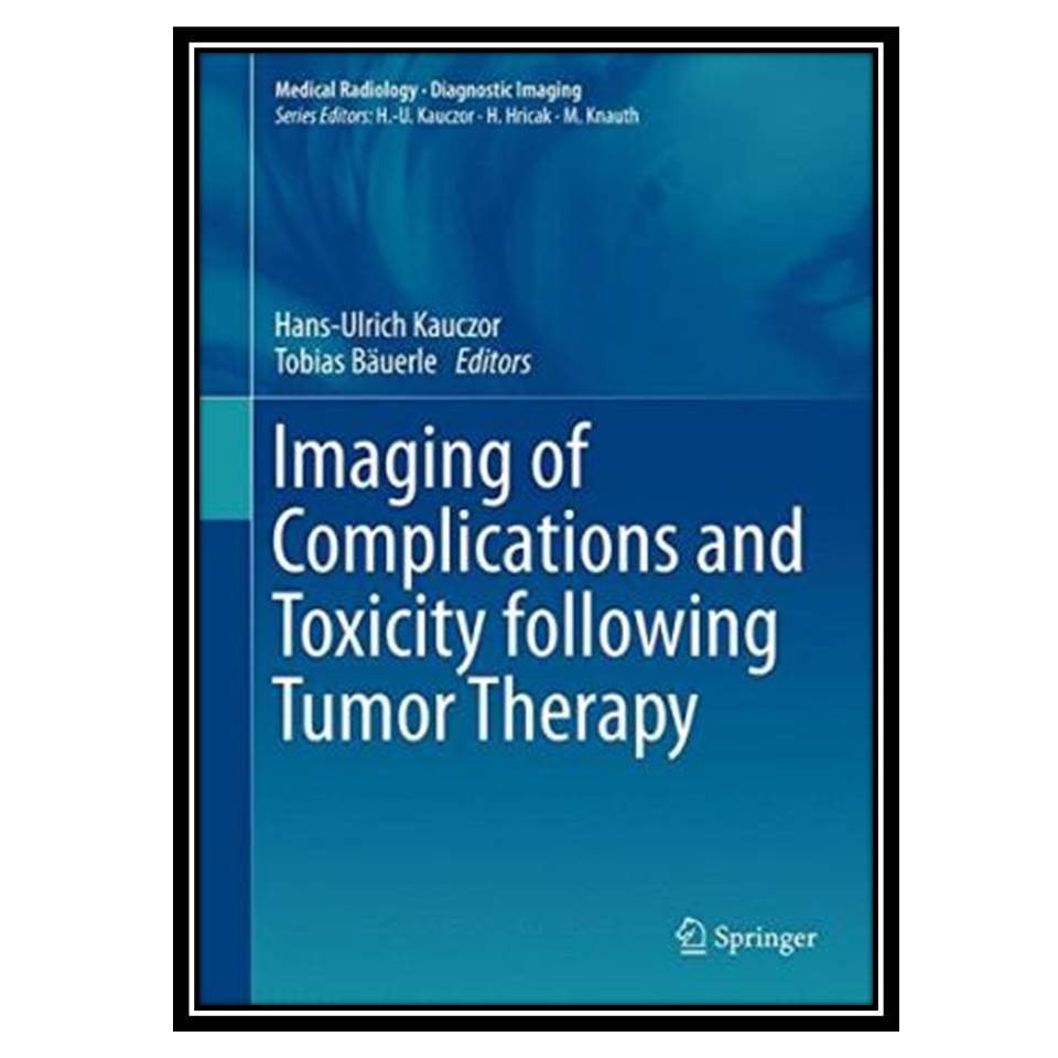 کتاب Imaging of Complications and Toxicity following Tumor Therapy اثر Hans-Ulrich Kauczor and Tobias Bäuerle انتشارات مؤلفین طلایی