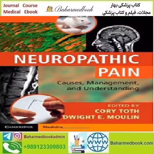 Neuropathic Pain Causes Management and Understanding 2