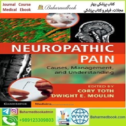 Neuropathic Pain Causes Management and Understanding 2