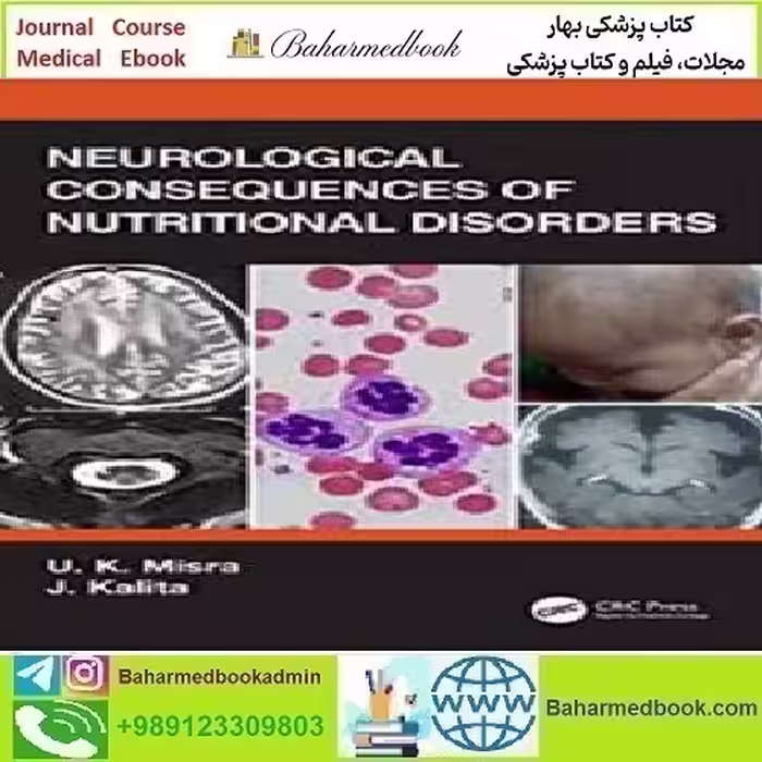 Neurological Consequences of Nutritional Disorders 2021