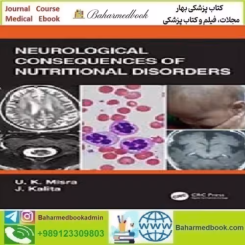 Neurological Consequences of Nutritional Disorders 2021