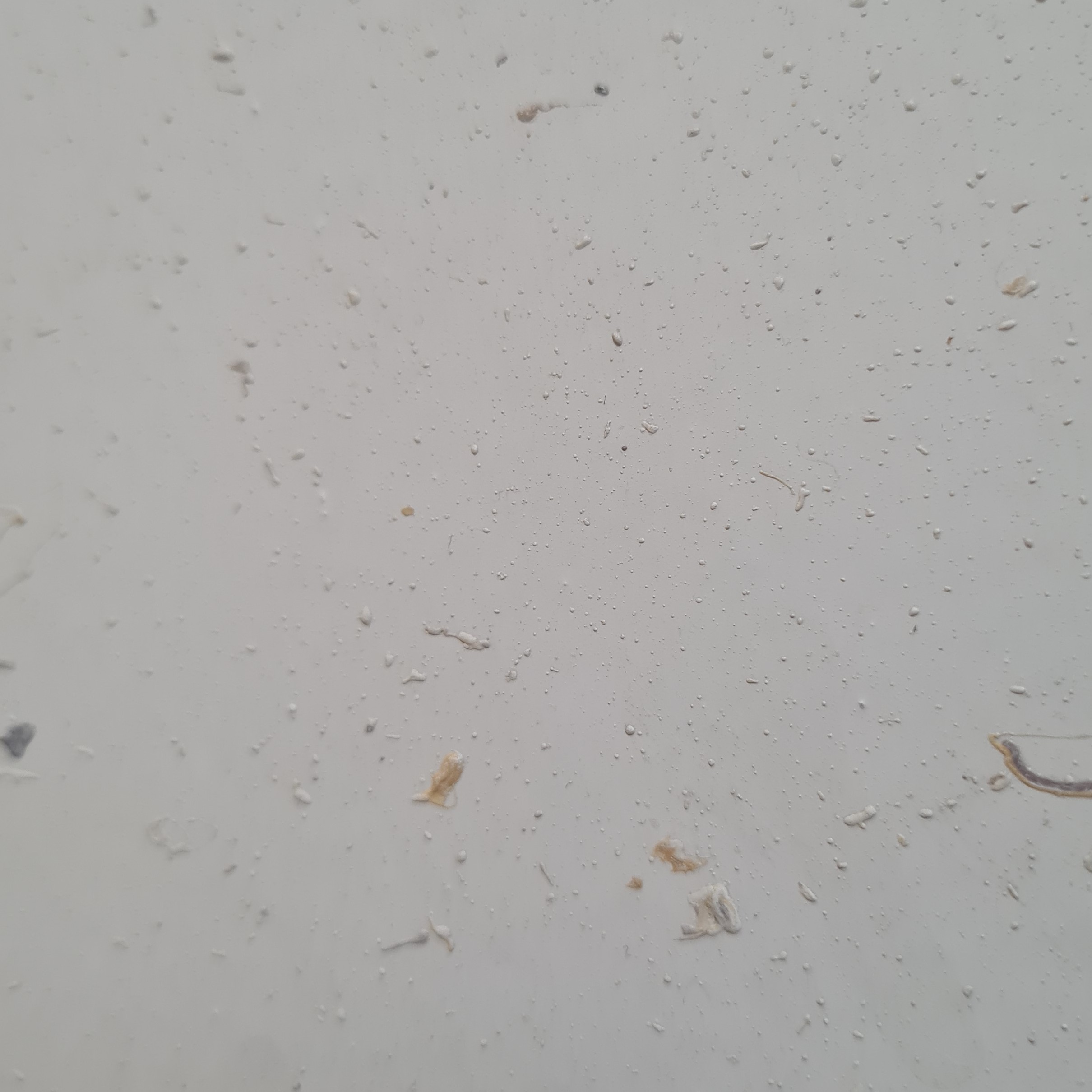 کنترل کامل دو ریموت قفل مقابل برقی و به همراه مقابل برقی الکتروپیک 