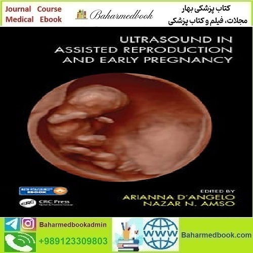 Ultrasound in Assisted Reprodution