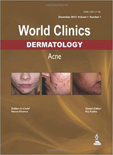 Acne (World Clinics in Dermatology) 2014 - کتاب پزشکی بهار