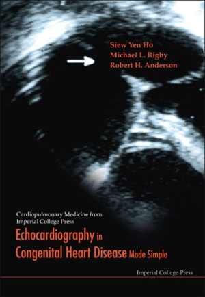 [PDF] دانلود کتاب Echocardiography In Congenital Heart Disease Made Simple, 2005