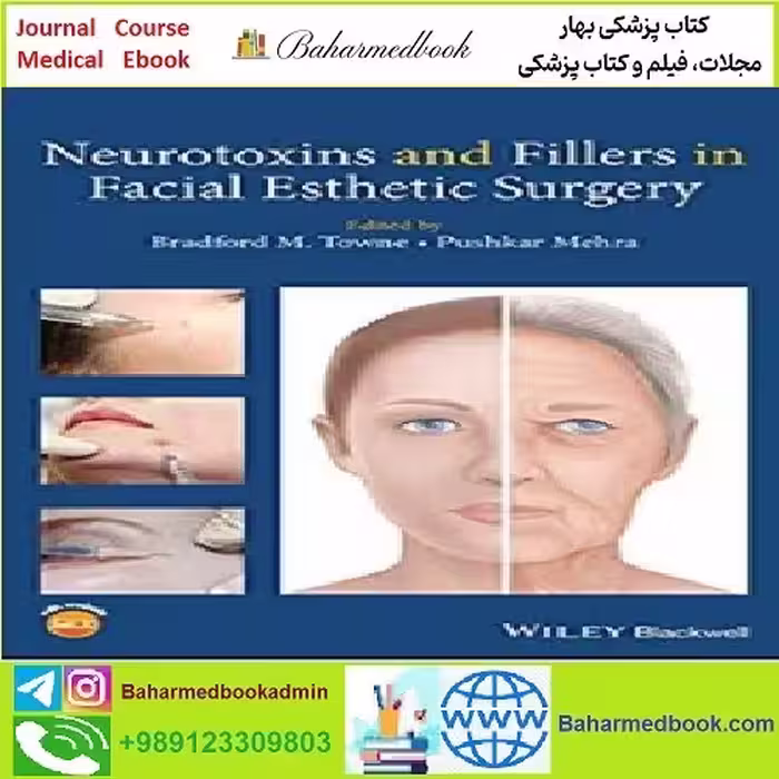Neurotoxins and Fillers in Facial Esthetic Surgery TRUE PDF pri