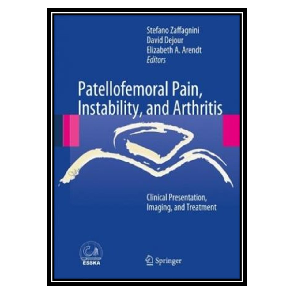 کتاب Patellofemoral Pain, Instability, and Arthritis: Clinical Presentation, Imaging, and Treatment اثر جمعی از نویسندگان انتشارات مؤلفین طلایی