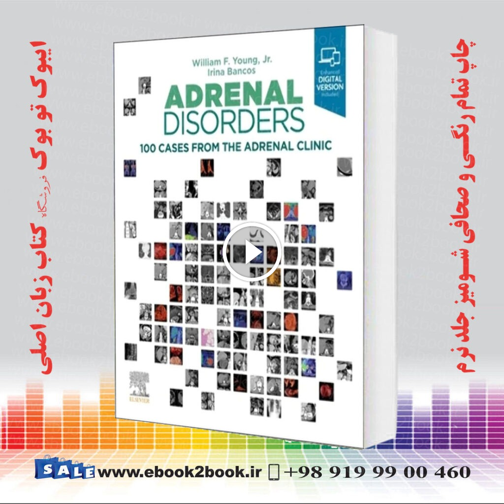 Adrenal Disorders: 100 Cases from the Adrenal Clinic