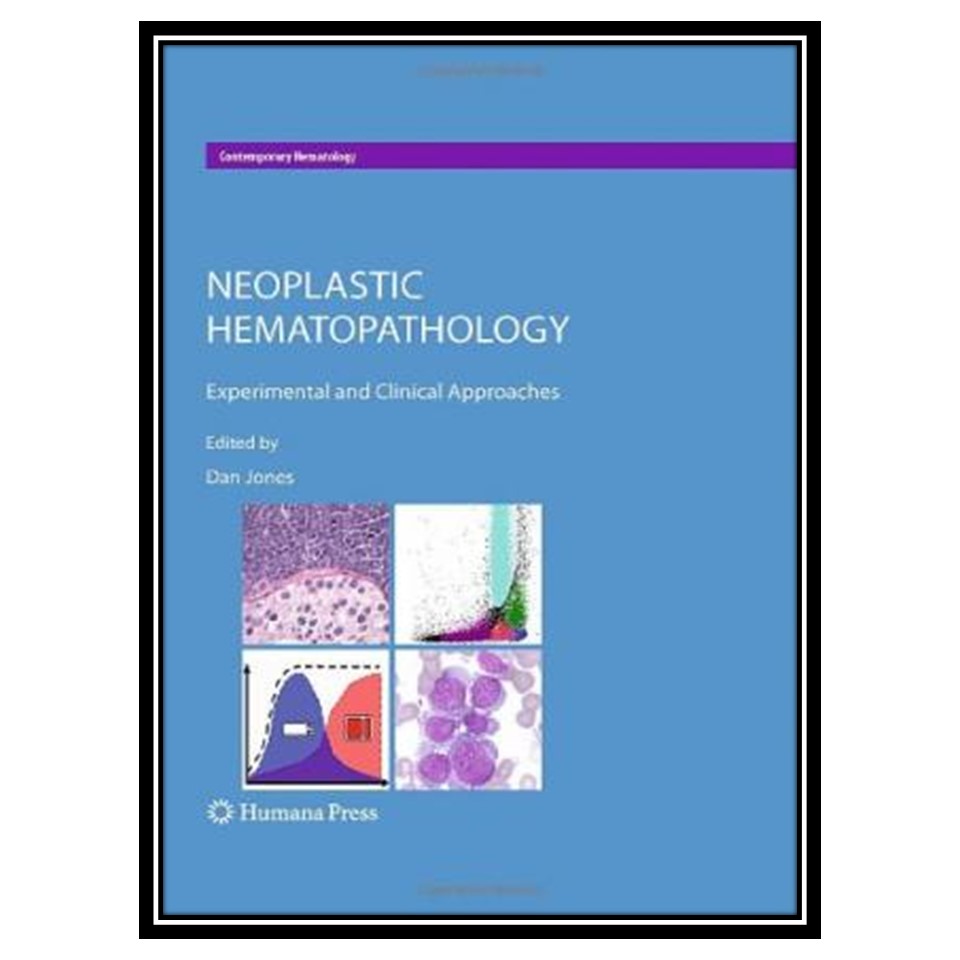 کتاب Neoplastic Hematopathology: Experimental and Clinical Approaches اثر Dan Jones and Dan Jones انتشارات مؤلفین طلایی