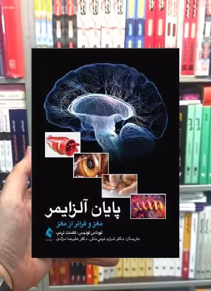 پایان آلزایمر مغز و فراتر از مغز ارجمند