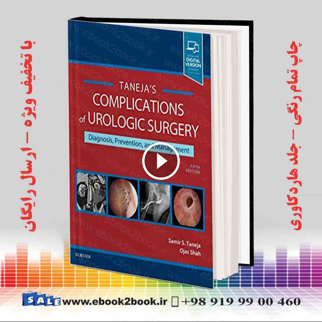 Complications of Urologic Surgery 5th Edition
