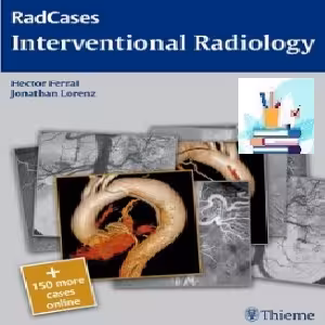 Interventional Radiology TRUE PDF price 1€
