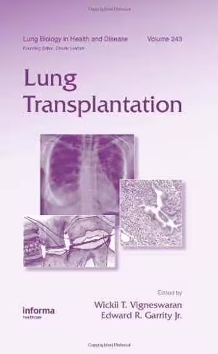 [PDF] دانلود کتاب Lung Transplantation, 2010
