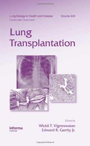[PDF] دانلود کتاب Lung Transplantation, 2010