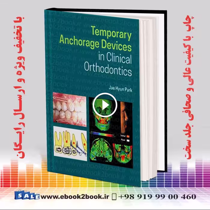 Temporary Anchorage Devices in Clinical Orthodontics