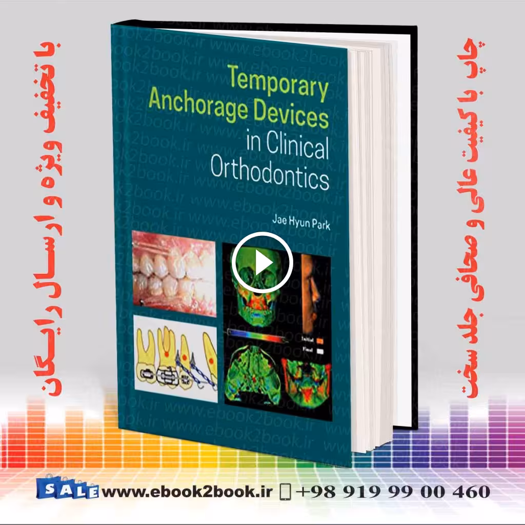 Temporary Anchorage Devices in Clinical Orthodontics