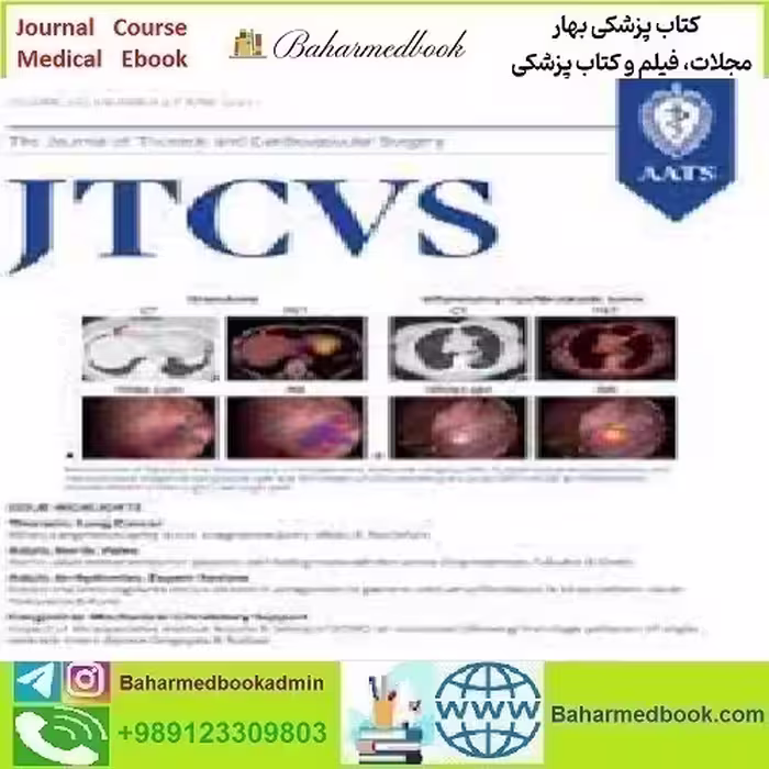 The Journal of Thoracic and Cardiovascular Surgery Volume