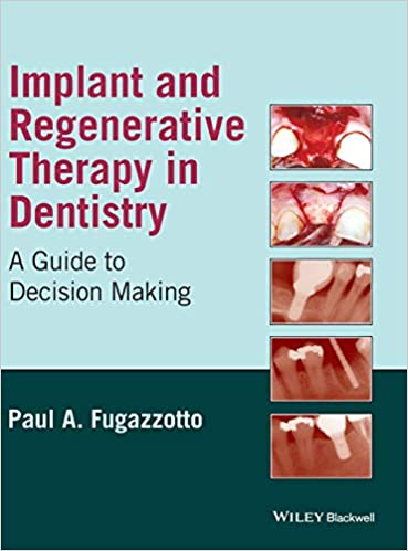 󾕇 دانلود کتاب Implant And Regenerative Therapy In Dentistry - A Guide To Decision Making, 2009 - دانلود کتاب های دانشگاهی