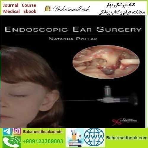 Endoscopic Ear Surgery 2014 TRUE PDF price 1€ - کتاب پزشکی بهار