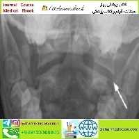 Neuroradiology Review for the Practicing Radiologist 2018 video c