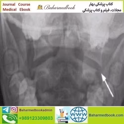 Neuroradiology Review for the Practicing Radiologist 2018 video c