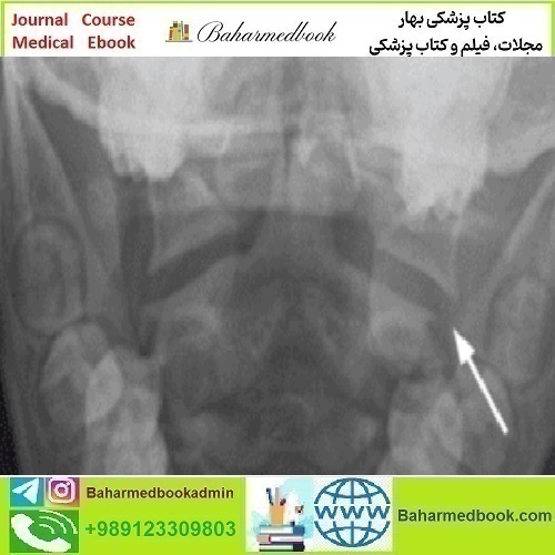 Neuroradiology Review for the Practicing Radiologist 2018 video c