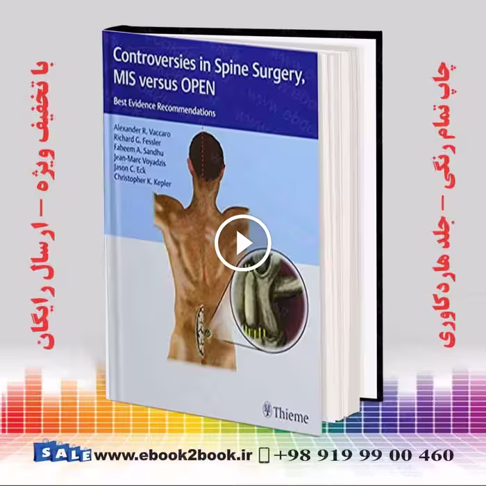 Controversies in Spine Surgery MIS versus OPEN