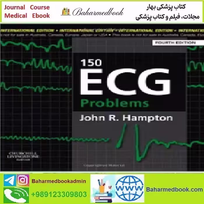 150ECG Problems TRUE PDF price 1€ - کتاب پزشکی بهار