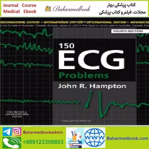 150ECG Problems TRUE PDF price 1€ - کتاب پزشکی بهار
