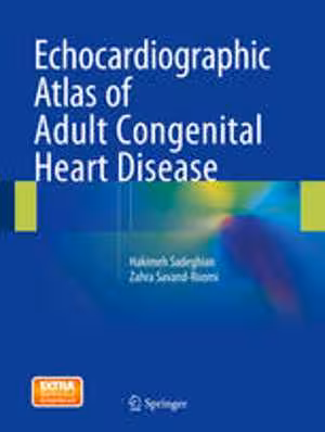 [PDF] دانلود کتاب Echocardiographic Atlas Of Adult Congenital Heart Disease, 2015