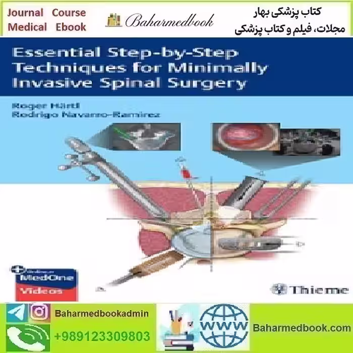 Essential Step by Step Techniques for Minimally Invasive Spinal