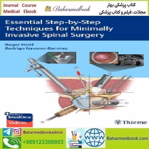 Essential Step by Step Techniques for Minimally Invasive Spinal