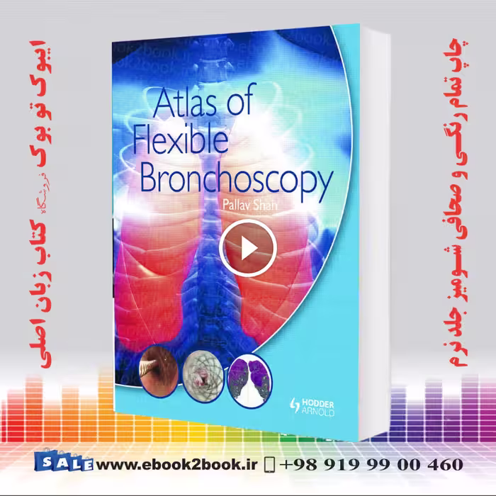Atlas of Flexible Bronchoscopy